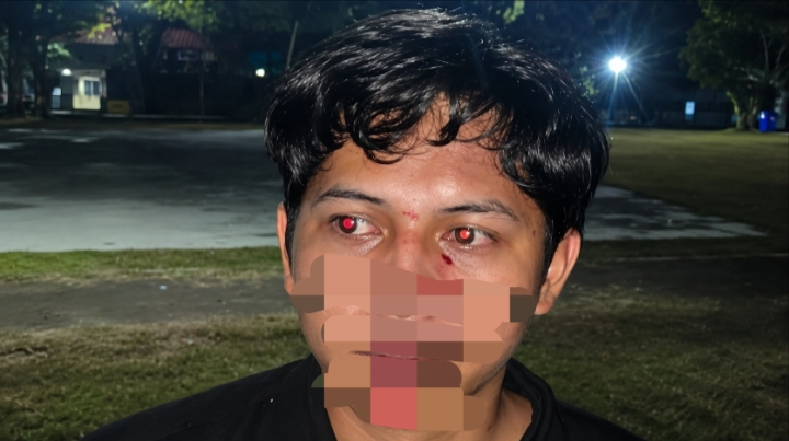 PA GMNI Ciamis Kecam Pengeroyokan-lintaspriangan